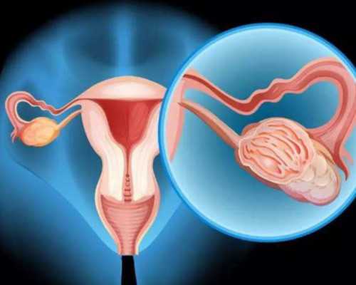 代孕妇食物中毒怎么治疗