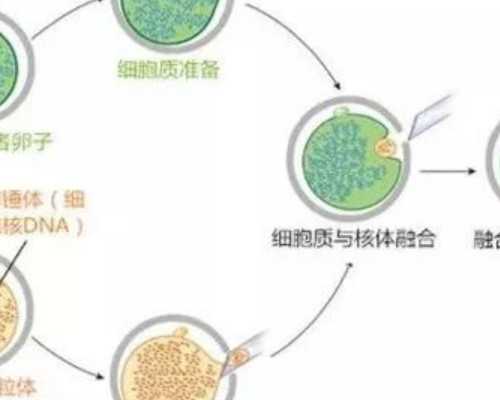 贵阳助孕妇公司,深圳试管婴儿公司贵吗？