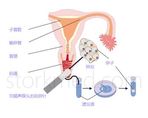 深圳合法代孕-深圳代孕好找吗-深圳非法代孕中介怎么举报