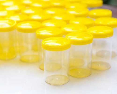 做试管婴儿男士需要做什么准备_第三代试管代助孕包生男孩多少费用？