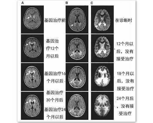 供卵试管生儿子一键咨询_谁去代生成功