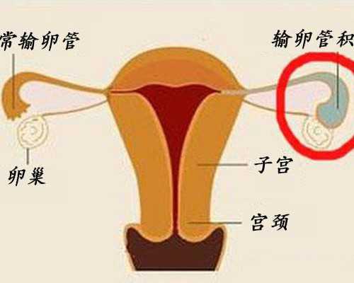 深圳正规代孕妈妈_深圳代孕费用高承受不起【代孕无忧包性别，圆您求子心愿