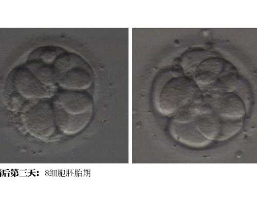 代孕价格,孕晚期洗澡能洗肚子吗
