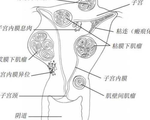 严重孕吐怎么办20261213144024来源网友分享评论0点击