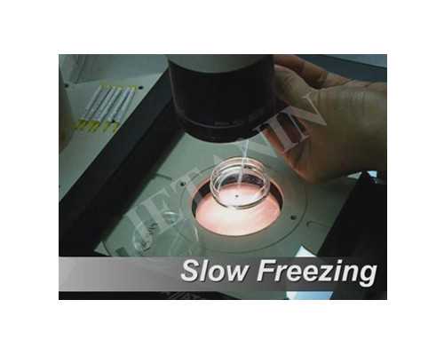 深圳供卵试管服务网,多囊卵巢供卵成功率高吗