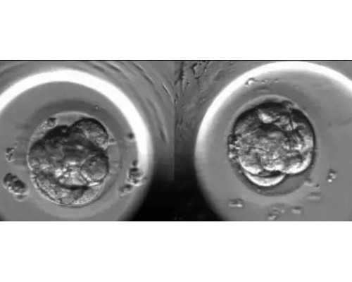 深圳代孕套餐-深圳做代孕要多长时间-不孕不育会遗传下一代吗