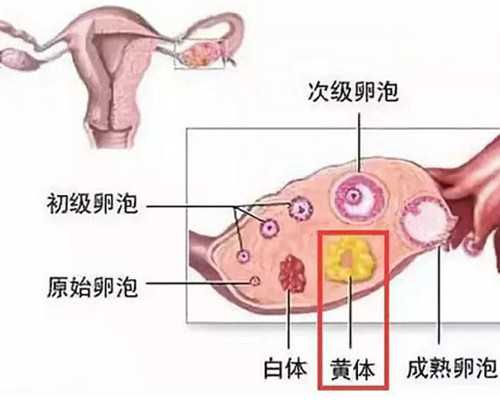 肾结石在肾门处怎么回事怎么办