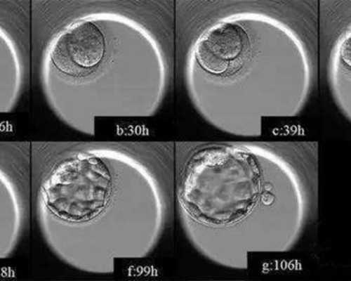 2026深圳大学第一附属医院做试管供卵生男孩费用全新分析