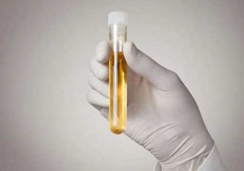 国外买精子需要多少钱，停经了借卵可以做试管吗