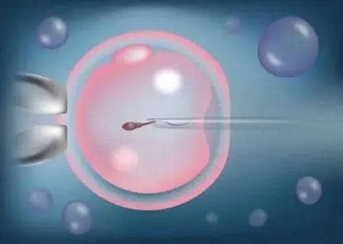 助孕中心_代孕套餐_同性恋怎样找代孕