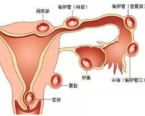 代孕小孩需要多少钱～借卵生子注意什么～哺乳