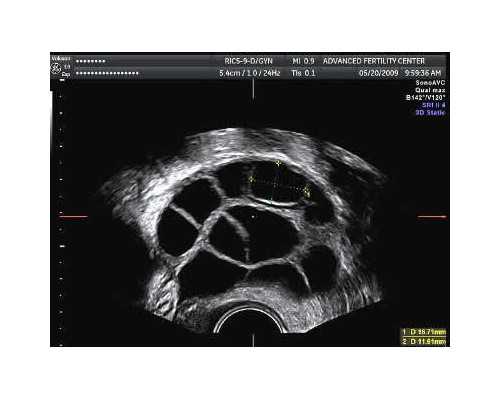 深圳代孕网-深圳寻代代孕妈妈【深圳权威专家指导，精准代孕成功率高】