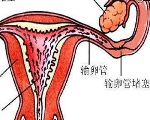 军人做试管婴儿全免#南京国内代孕违法吗