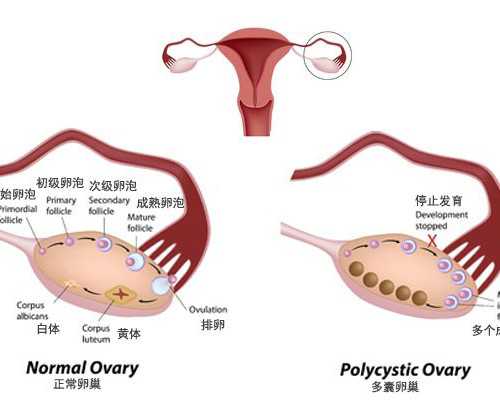 手部先天畸形的种类