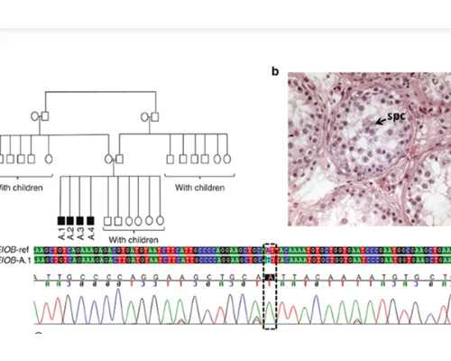 「精子质量」男人少精弱精能吃****?这3类男性千万别碰!