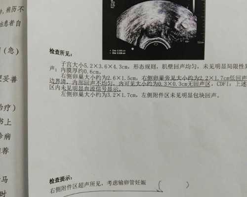 代孕妇可以吃生芒果吗