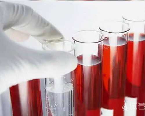 单身做试管多久可以测出来是宫内还是宫外孕