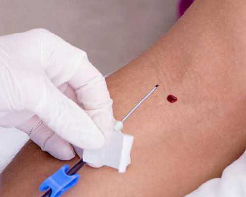 西安做供卵试管技术能包生男孩是真的吗