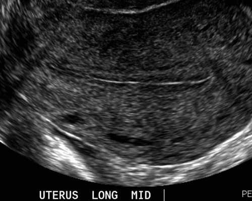 深圳代孕价格-深圳代生宝宝【深圳科学代孕，无忧包性别】