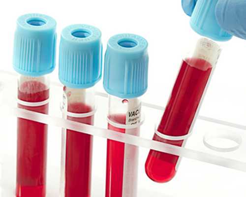 输卵管子宫内膜异位症，这样治她怀上了！