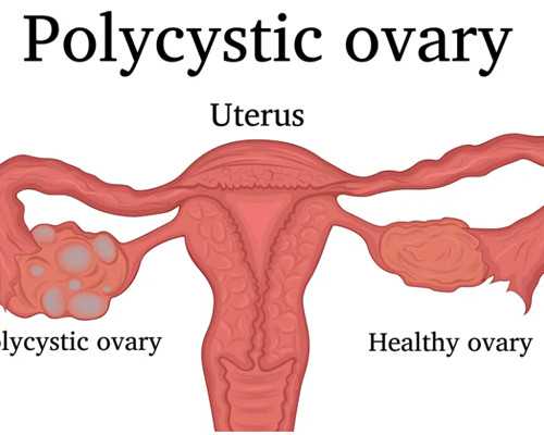 深圳自然代怀孕过程_代怀代生多少钱,子宫性不孕