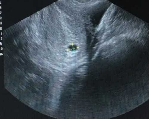 深圳代怀宝宝-供卵机构排名【科学代孕，健康产子不是梦。】