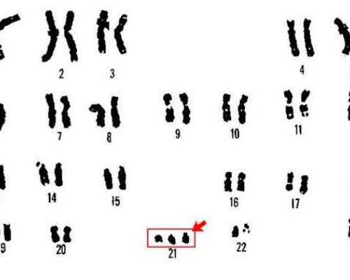 有帮着代孕的-单身男士如何代孕【圆梦行动精准代孕】