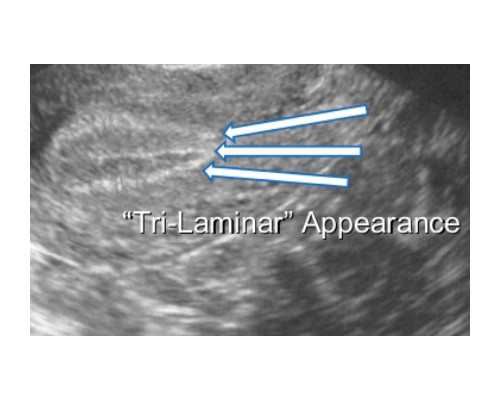 深圳代孕中介_深圳个人有偿找代孕妈妈_一胎肚脐看二胎性别