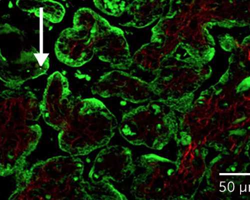中国如何去格鲁吉亚做试管,中国去格鲁吉亚能去吗