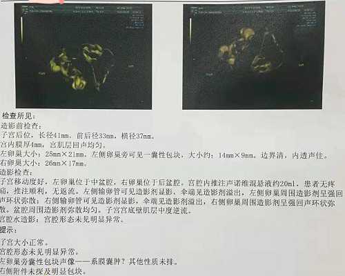 代孕妇早上空腹能吃什么