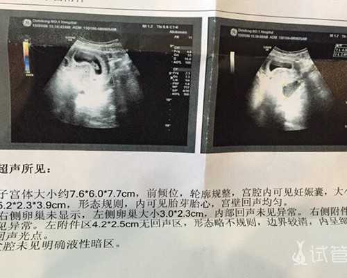 加长版“双11”再创纪录，广东再夺“剁手”冠军