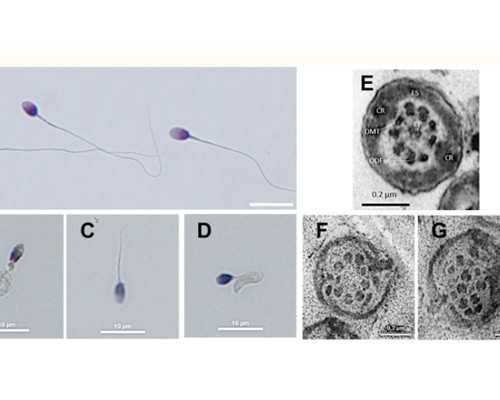 品牌代孕网-国内借卵中心-进入孕晚期，孕妈容易