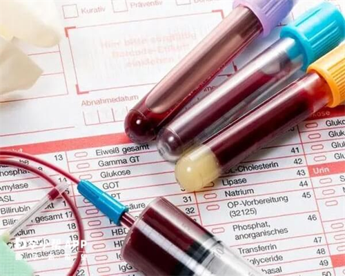 深圳代孕受保~深圳输卵管造影不要随便做孕代孕