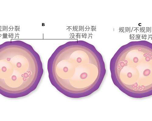 深圳代孕中心-深圳代孕妈妈志愿者-深圳代孕需要做什么准备