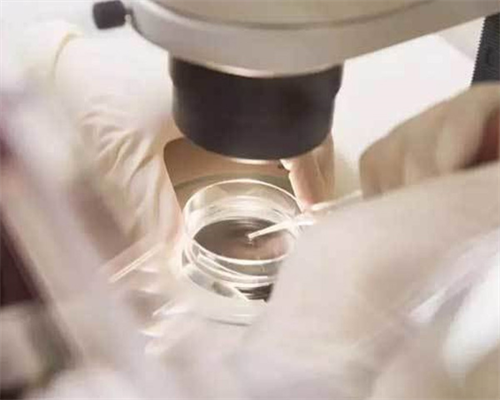 深圳代孕成功率_深圳哪里需要代孕母亲_降低高血压饮食疗法