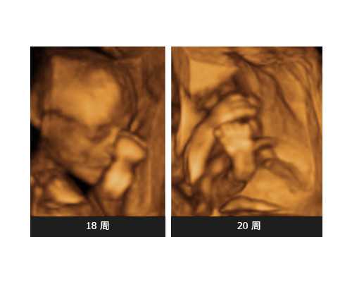 深圳中国代怀排名_解答：到底是卵子还是精子决定了美国试管胚胎质量？