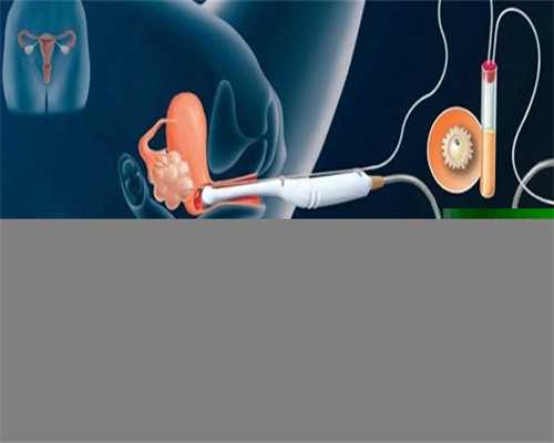 找代孕有哪些后遗症_精子少能治好吗