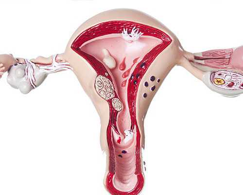 深圳代孕哪家公司好_孕妇能不能吃苦刺花