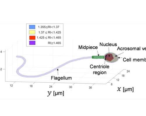多囊卵巢肚子大图片~宫腔粘连有什么危害