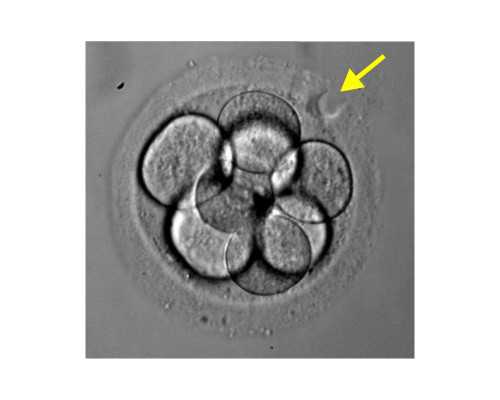 成都供卵抽产检准确吗,【成都有供卵试管婴儿吗】分享整个孕期和生产经历，