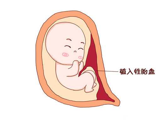 盐城子宫小可以借卵生子吗，盐城试管供卵代生多少钱