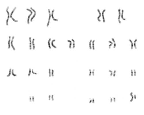 代生哪家好-深圳代生-供卵代生多少钱