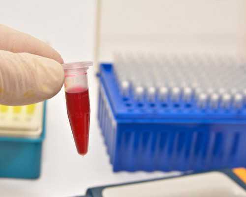 怀孕二个月孕妇饮食表怎样照顾孕妇的日常饮食