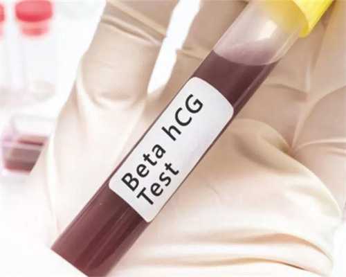 深圳有谁愿意代孕-深圳代孕机构哪家最专业-卵泡23了怎么安排同房