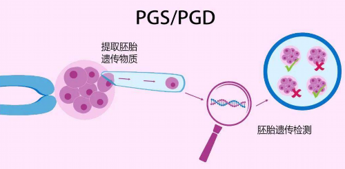 深圳助孕怎么做的_深圳2020年助孕价格【传宗接助,深圳助孕基地为您保驾护航