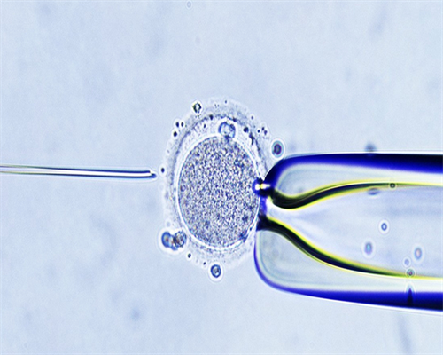 深圳供卵试管一次需要多少钱-深圳代生公司联系方式