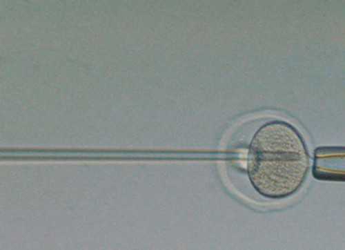 代孕中心,代孕妇八个月肚子疼是怎么回事