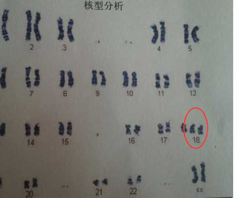 深圳代生孩子哪里找,深圳可以做三代试管的医院名单中有没有中山医院？