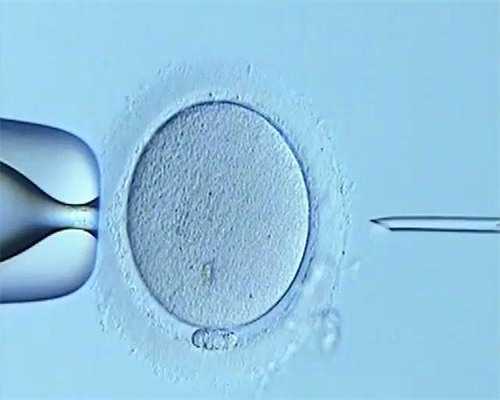深圳代孕医院-深圳试管婴儿代孕可以吗-痛经？这