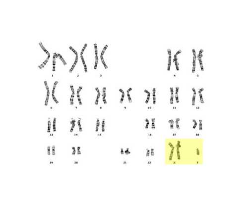 宫腔镜诊刮术后突然出血多了为什么？